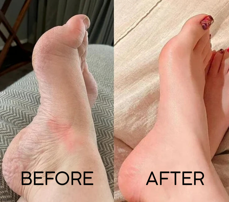VitalStep™ — Noticeably light, pain-free legs in just minutes daily