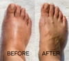 VitalStep™ — Noticeably light, pain-free legs in just minutes daily