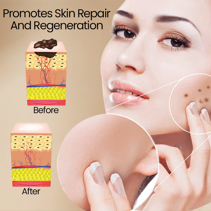 BUY ONE GET ONE FREE | BeeClear™ — Clear Away Skin Flaws to Reveal Your True Confidence