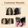 PureGrow™ Organic Hair Elixir — Reignite Your Hair’s Glory with Thick, Unbreakable Strands
