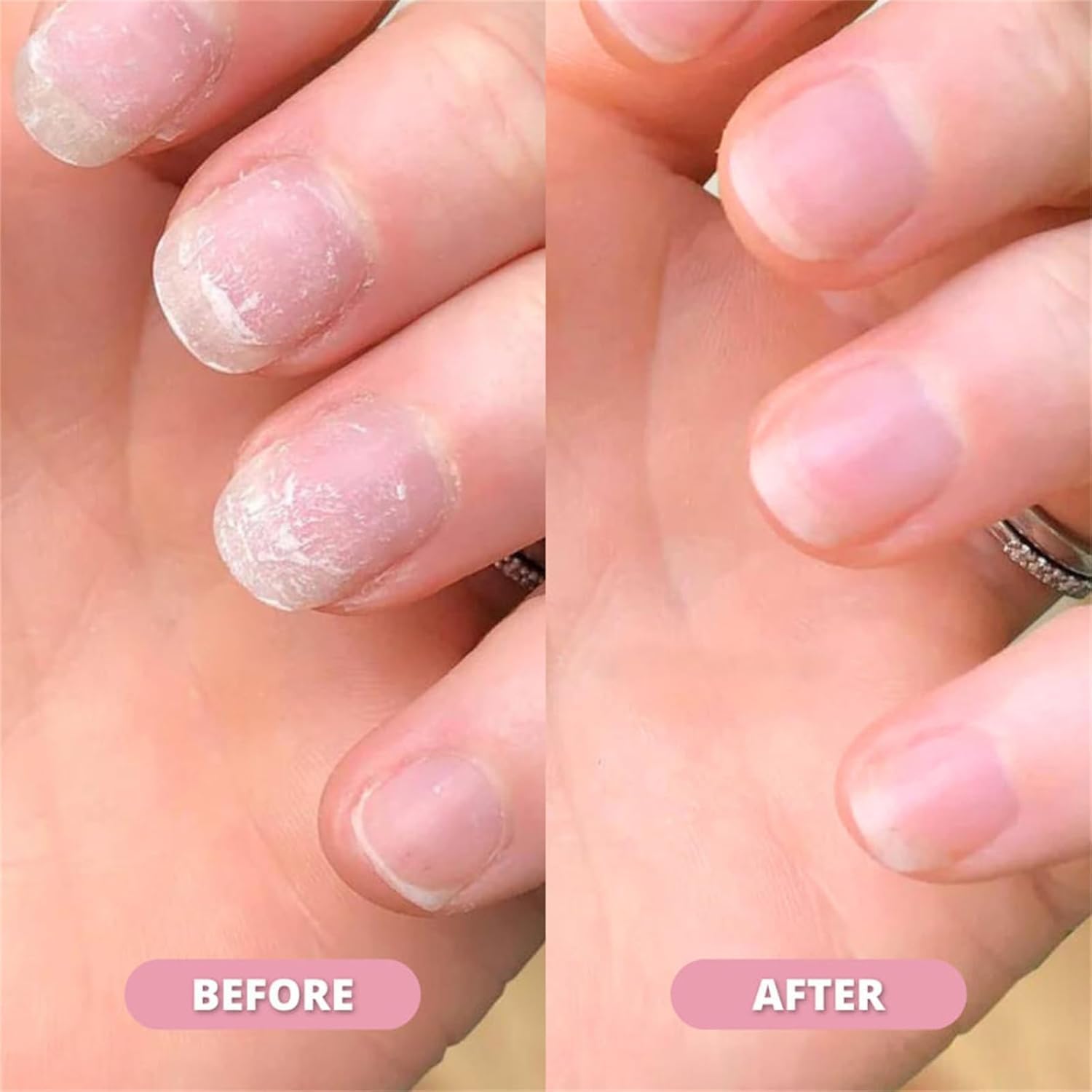 1+1 FREE | Nail Nourish Oil™ — Transform Fragile Nails into Stunning Strength and Shine