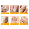FungiZap™ — Invisible Power for Healthy, Flawless Nails You Can Be Proud of Again | 1+1 Free