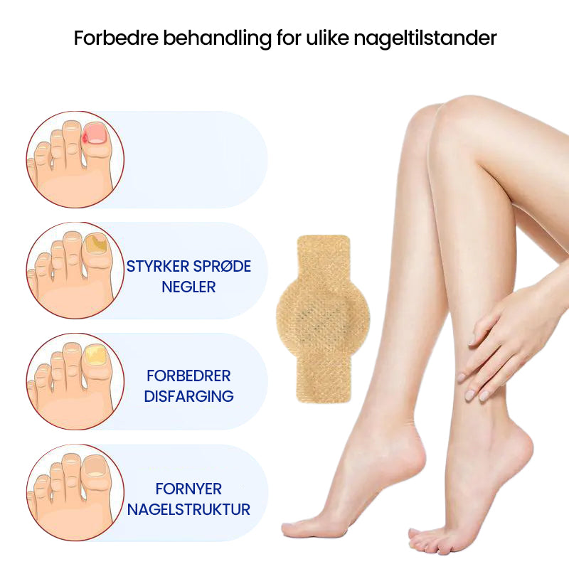 FungiZap™ — Invisible Power for Healthy, Flawless Nails You Can Be Proud of Again | 1+1 Free