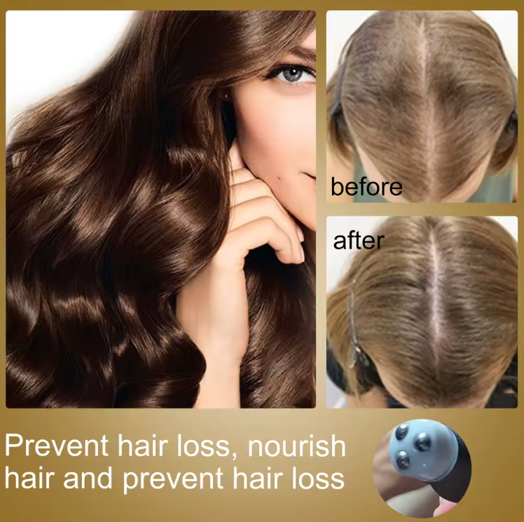 1+1 Free | Regrowth™ — Ignite Thick, Lush Hair Growth!