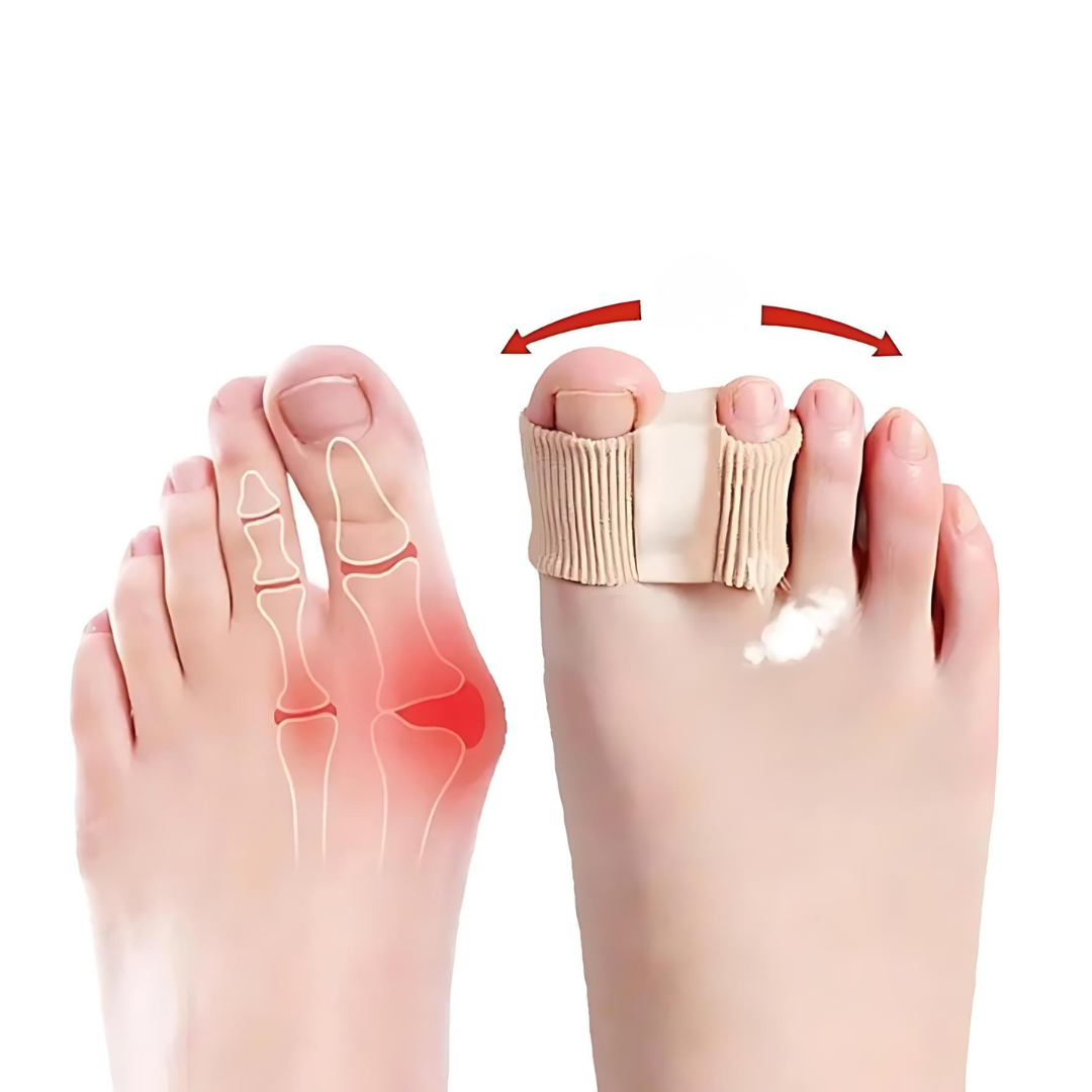 BunionFix™ — Step Pain-Free and Feel Balanced All Day Long