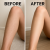 1+1 FREE | SmoothEase - Permanent Hair Removal!