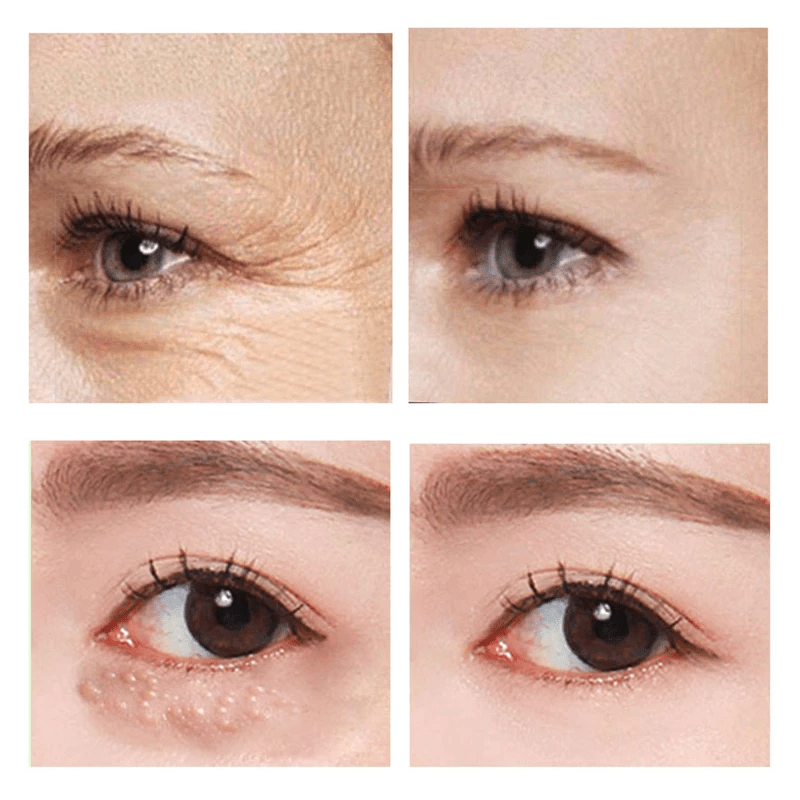 GlowEyes™ — Erase Puffiness & Wrinkles Instantly | 1+1 Free