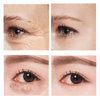 GlowEyes™ — Erase Puffiness & Wrinkles Instantly | 1+1 Free
