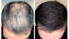 1+1 Free | Regrowth™ — Ignite Thick, Lush Hair Growth!