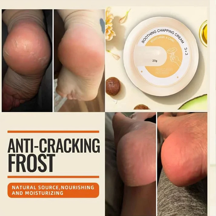 HydraHeel Moisturizing Cream™ — Heal and Hydrate Dry, Cracked Skin for Soft, Supple Comfort Every Day | 1+1 Free