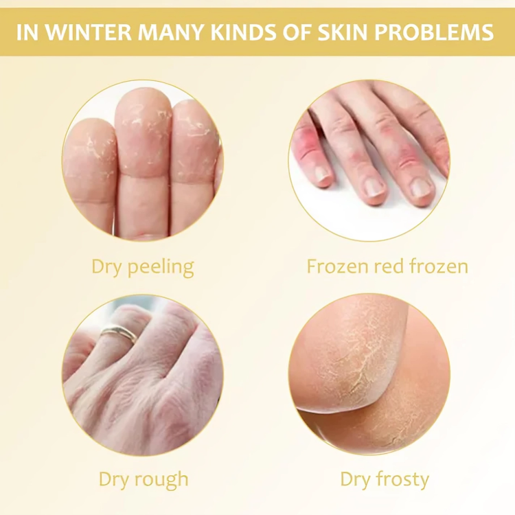 HydraHeel Moisturizing Cream™ — Heal and Hydrate Dry, Cracked Skin for Soft, Supple Comfort Every Day | 1+1 Free