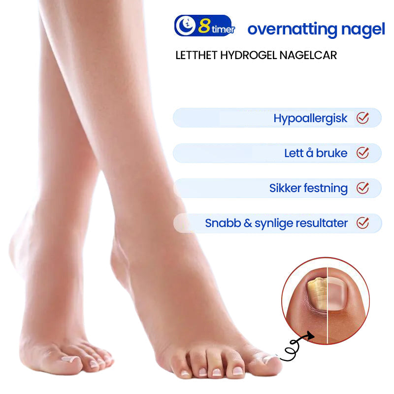 FungiZap™ — Invisible Power for Healthy, Flawless Nails You Can Be Proud of Again | 1+1 Free
