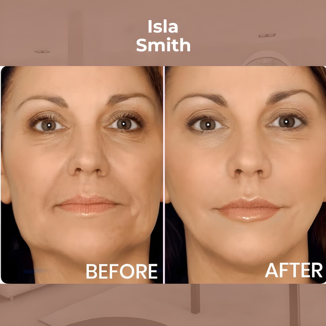 LiftVanta™ — Instantly Reveal Youthful, Rock-Solid Skin Without Effort (80pcs)