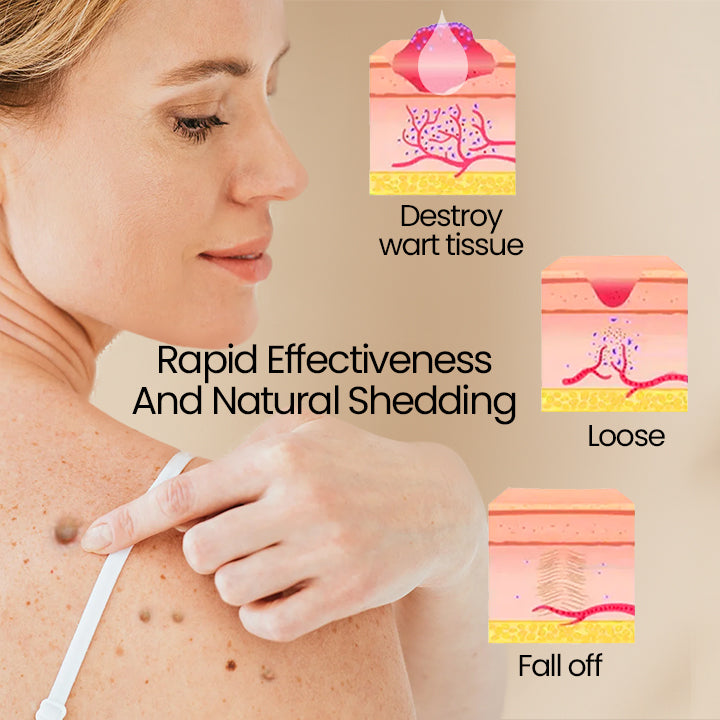 BUY ONE GET ONE FREE | BeeClear™ — Clear Away Skin Flaws to Reveal Your True Confidence