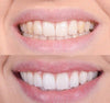 1+1 Free | FlashBright™ — Instantly Light Up Your Smile with Gentle, Lasting Power