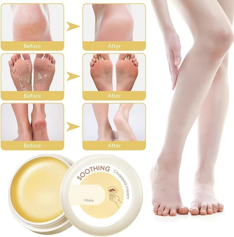 HydraHeel Moisturizing Cream™ — Heal and Hydrate Dry, Cracked Skin for Soft, Supple Comfort Every Day | 1+1 Free