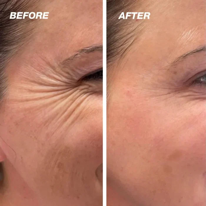 Buy One Get One Free | ScarGlow™ — Fade Scars Fast, Reveal Radiance!